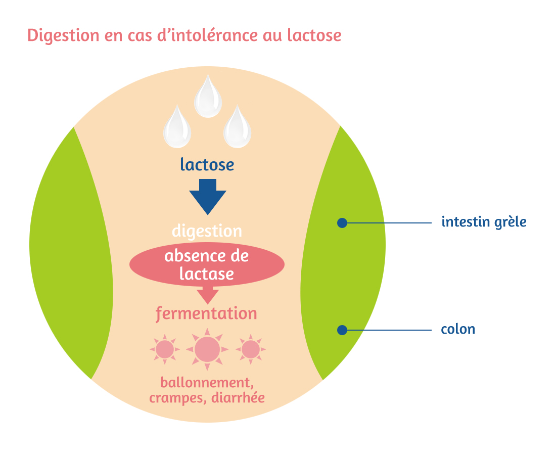 digestion-lactose-intolerance